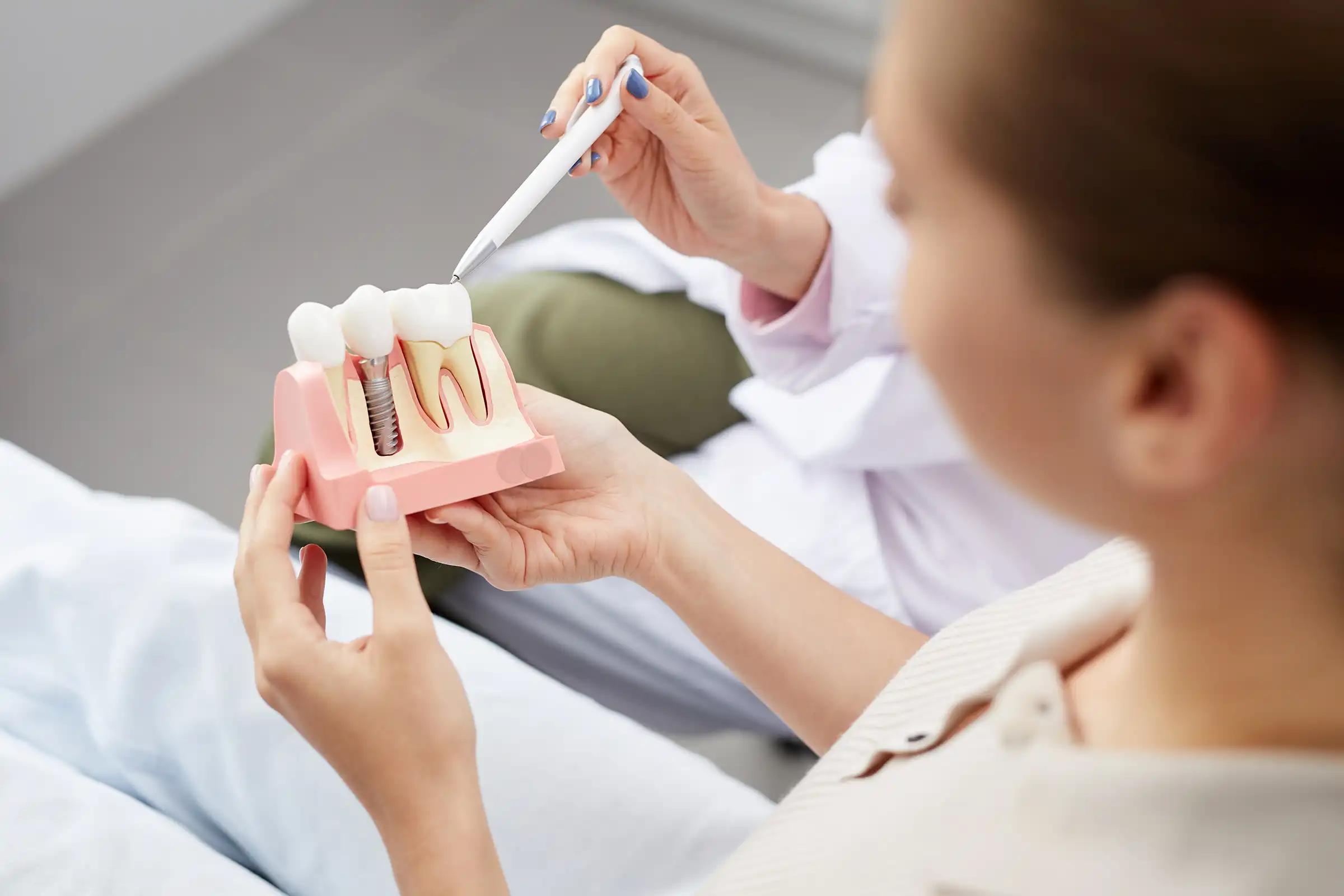 Dental Implants Dental Implants